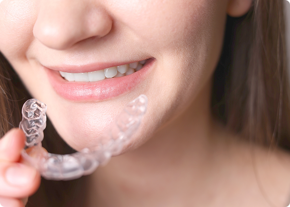 Paciente con alineador transparente MUV